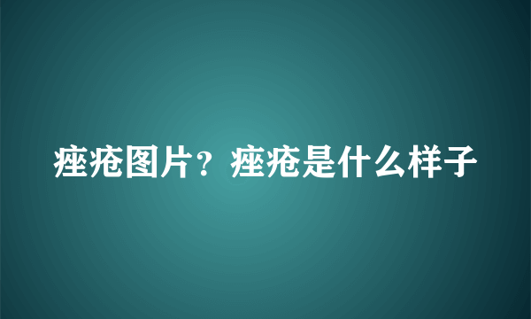 痤疮图片？痤疮是什么样子