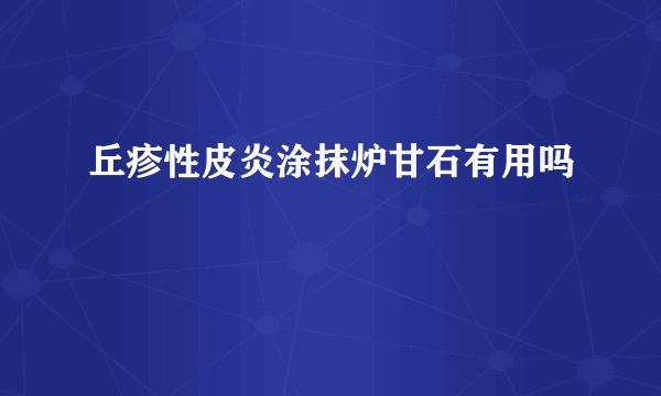 丘疹性皮炎涂抹炉甘石有用吗