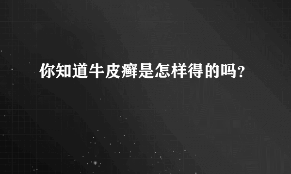 你知道牛皮癣是怎样得的吗？