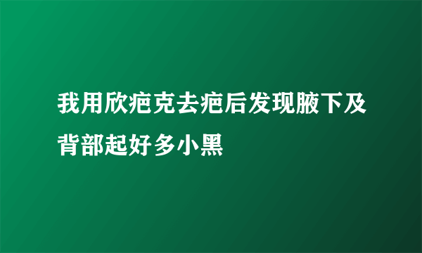 我用欣疤克去疤后发现腋下及背部起好多小黑