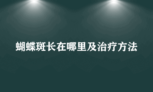 蝴蝶斑长在哪里及治疗方法