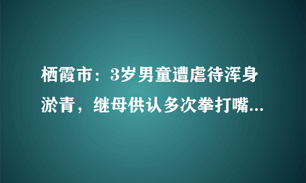 栖霞市：3岁男童遭虐待浑身淤青，继母供认多次拳打嘴咬, 你怎么看？