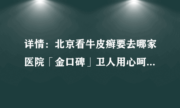 详情：北京看牛皮癣要去哪家医院「金口碑」卫人用心呵护牛皮癣健康-牛皮癣