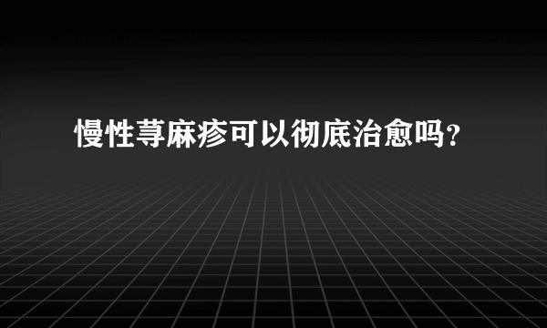 慢性荨麻疹可以彻底治愈吗？