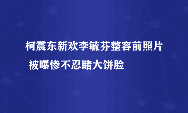 柯震东新欢李毓芬整容前照片 被曝惨不忍睹大饼脸