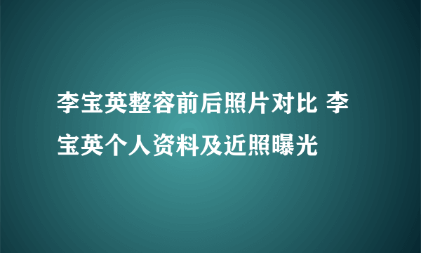 李宝英整容前后照片对比 李宝英个人资料及近照曝光