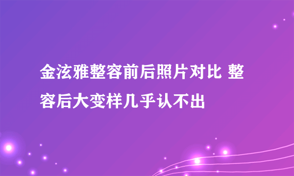 金泫雅整容前后照片对比 整容后大变样几乎认不出