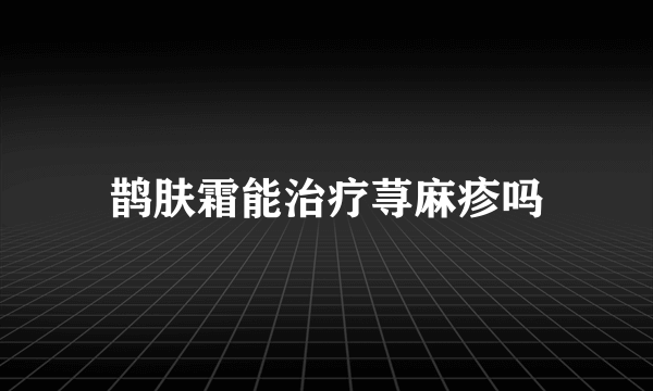 鹊肤霜能治疗荨麻疹吗