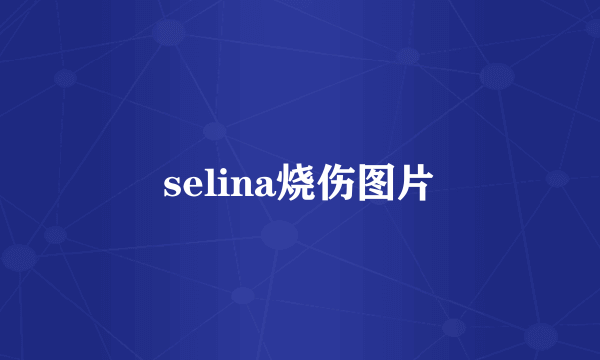 selina烧伤图片