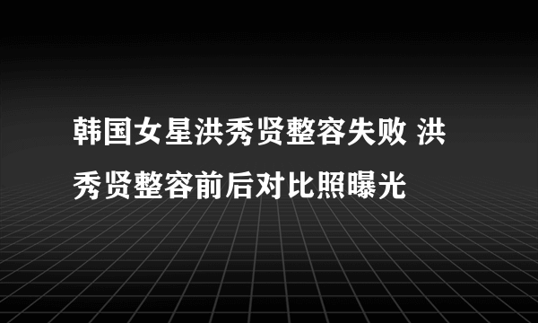 韩国女星洪秀贤整容失败 洪秀贤整容前后对比照曝光