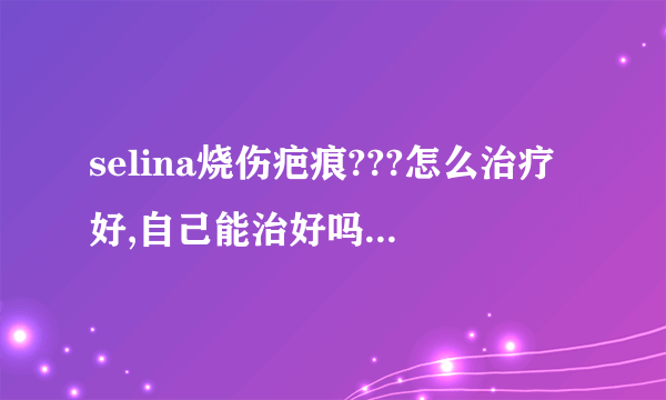 selina烧伤疤痕???怎么治疗好,自己能治好吗?需要多长时间