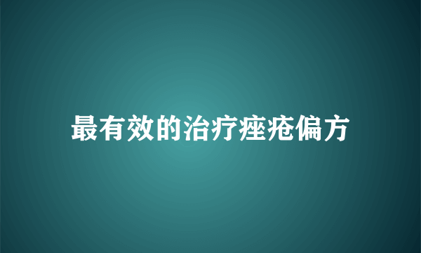 最有效的治疗痤疮偏方