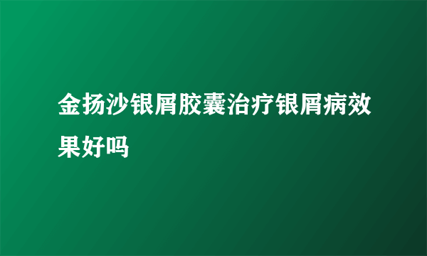 金扬沙银屑胶囊治疗银屑病效果好吗